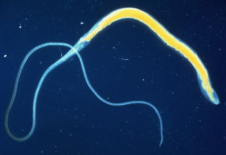 Το whipworm είναι ένα κοινό εντερικό παράσιτο.