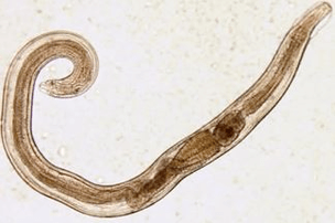 Pinworms στο ανθρώπινο σώμα