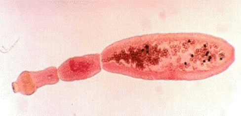 Πώς μοιάζει το Echinococcus στο ανθρώπινο σώμα
